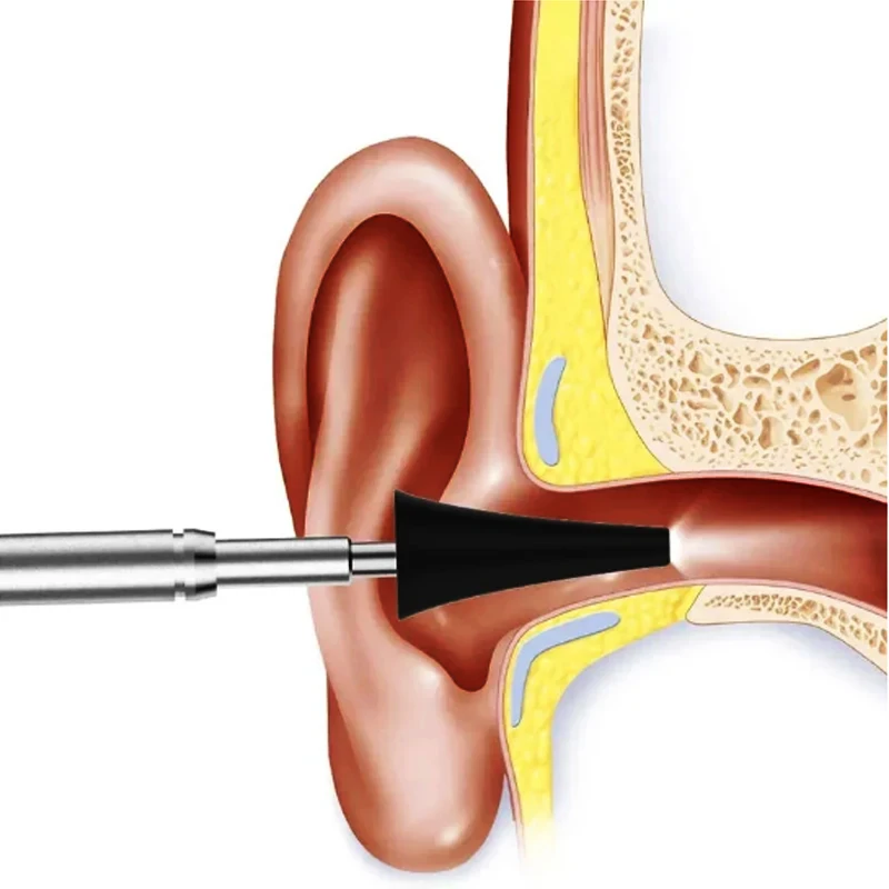 Accessori per otoscopio digitale da 3,9 mm Il specula auricolare riutilizzabile per adulti/bambini definisce strumenti di ispezione del canale