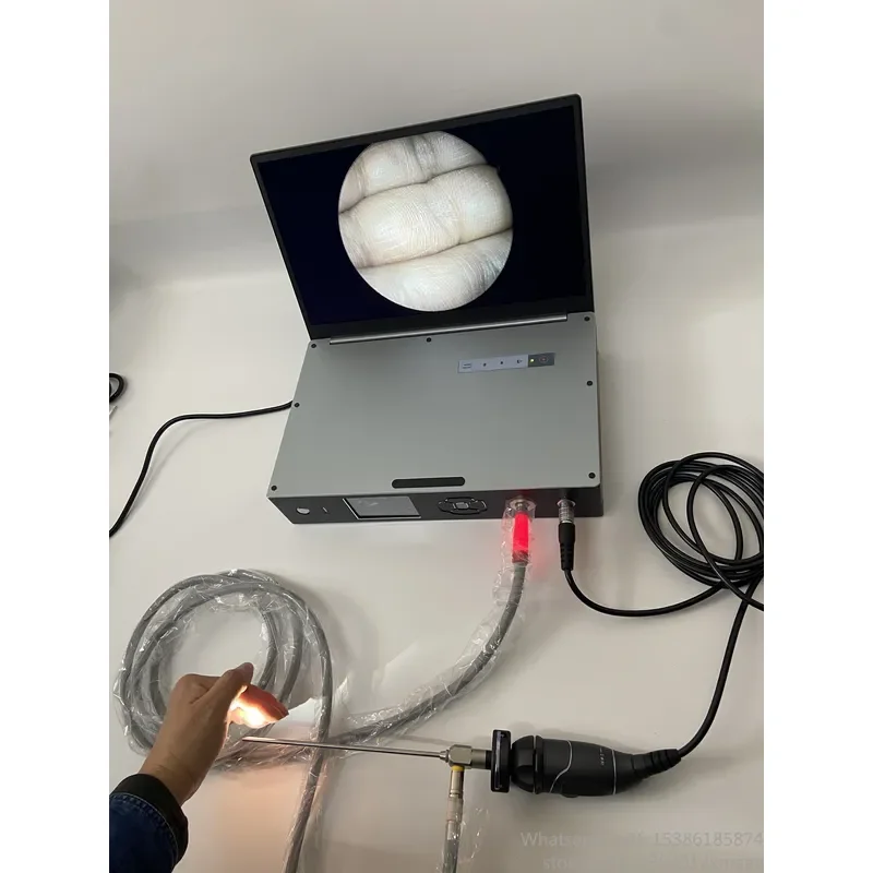 All-in-One 3-in-1 Endoscopy Camera System 1080P 60FPS 15.6-inch Screen 100W LED Light