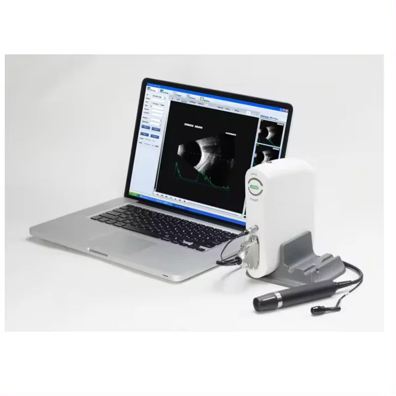 Sw-2100 Medical Eye Measurement Ophthalmic Ultrasound A/b Scanning Optical Biometer