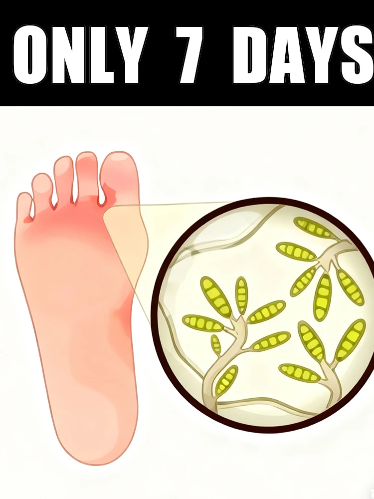 

7-Day Foot Exfoliating Spray, suitable for dry, rough, cracked feet, heels, and calluses.