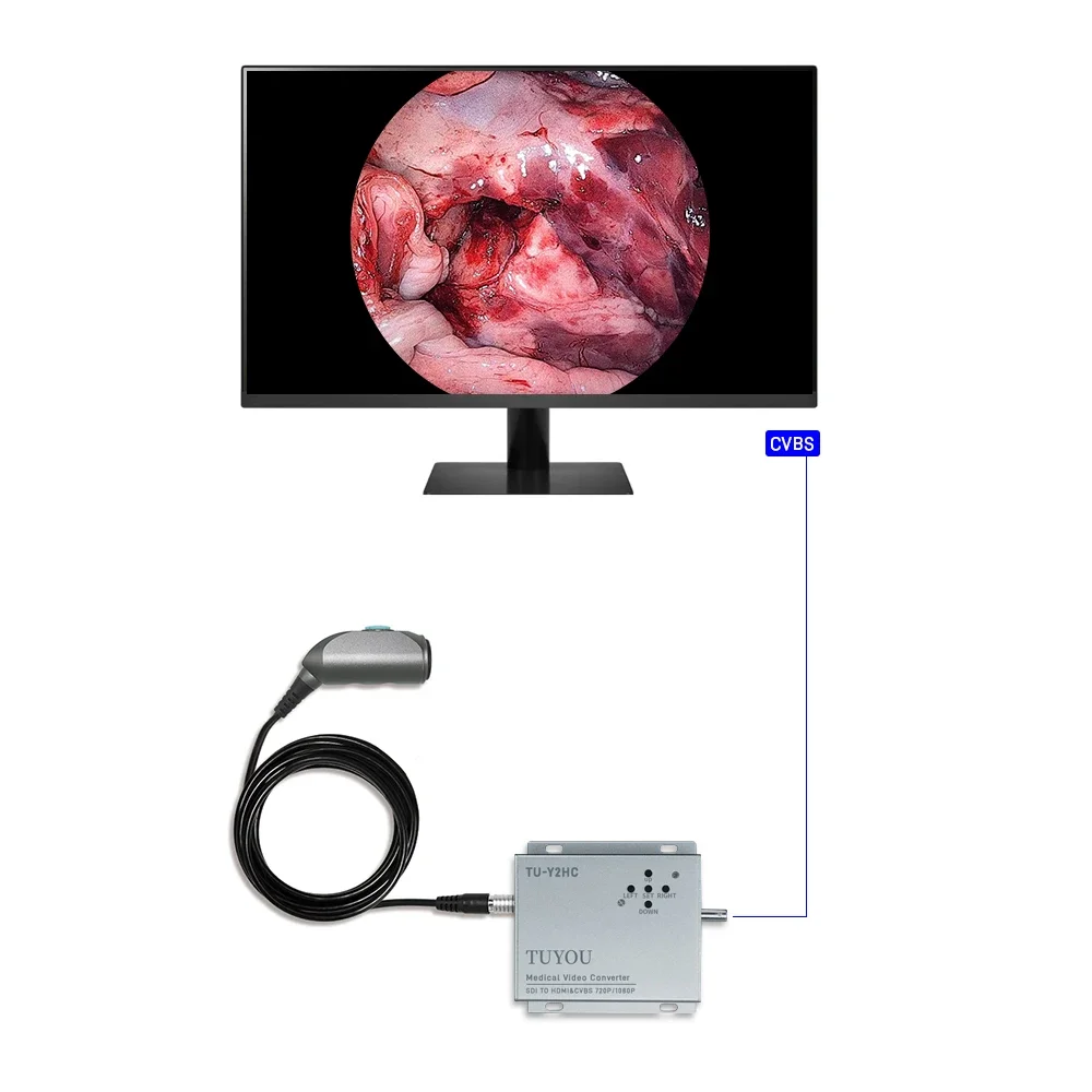 HDMI/CVBS HD Portable Medical Endoscope Handle Recording Device for Laparoscopy gynecology Urology ENT surgery