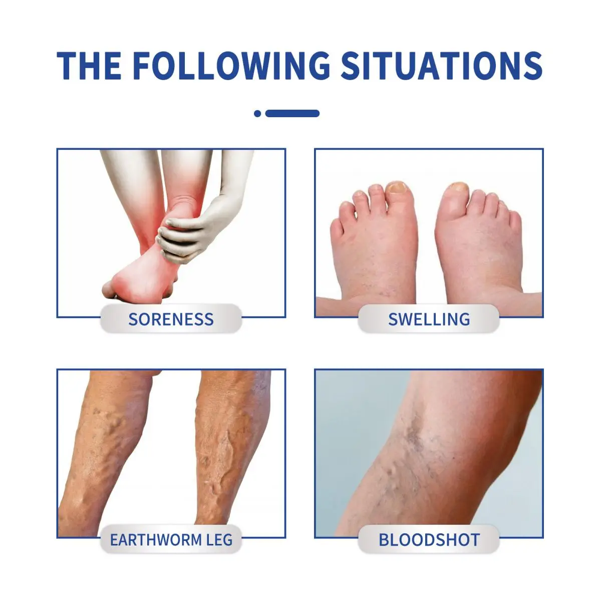 2023 Latest Varicose Pain Treatment Phlebitis Vasculitis Rotten Leg Spider Leg Treatment Cream face creams for women