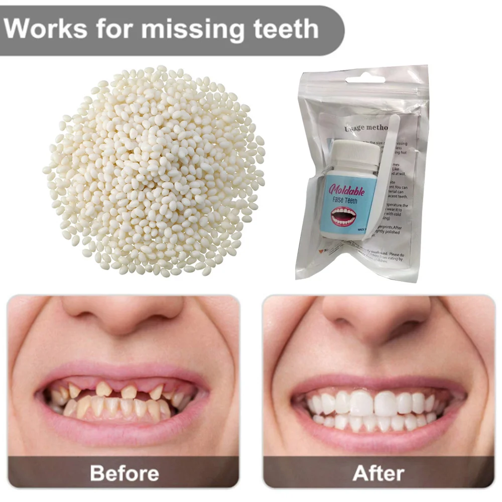 10-100g Resin Tooth Repair Glue Temporary Tooth Repair Kit Shapeable Teeth Gaps Filling Solid Glue Repair Dentures Broken Teeth