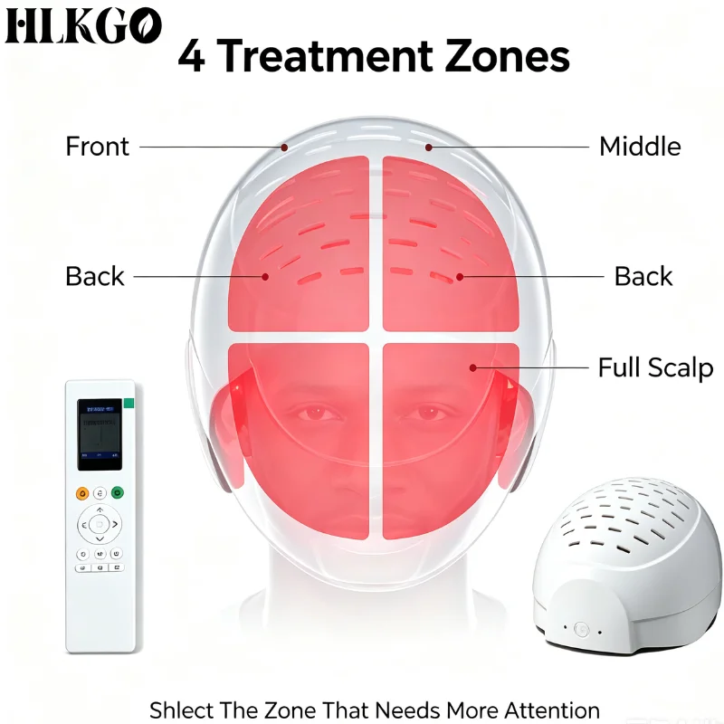 High Power 300 Diodes 650nm Painless Non-Invasive LLLT Laser Hair Growth Helmet Red Light Cap for Baldness Regrowth Treatment