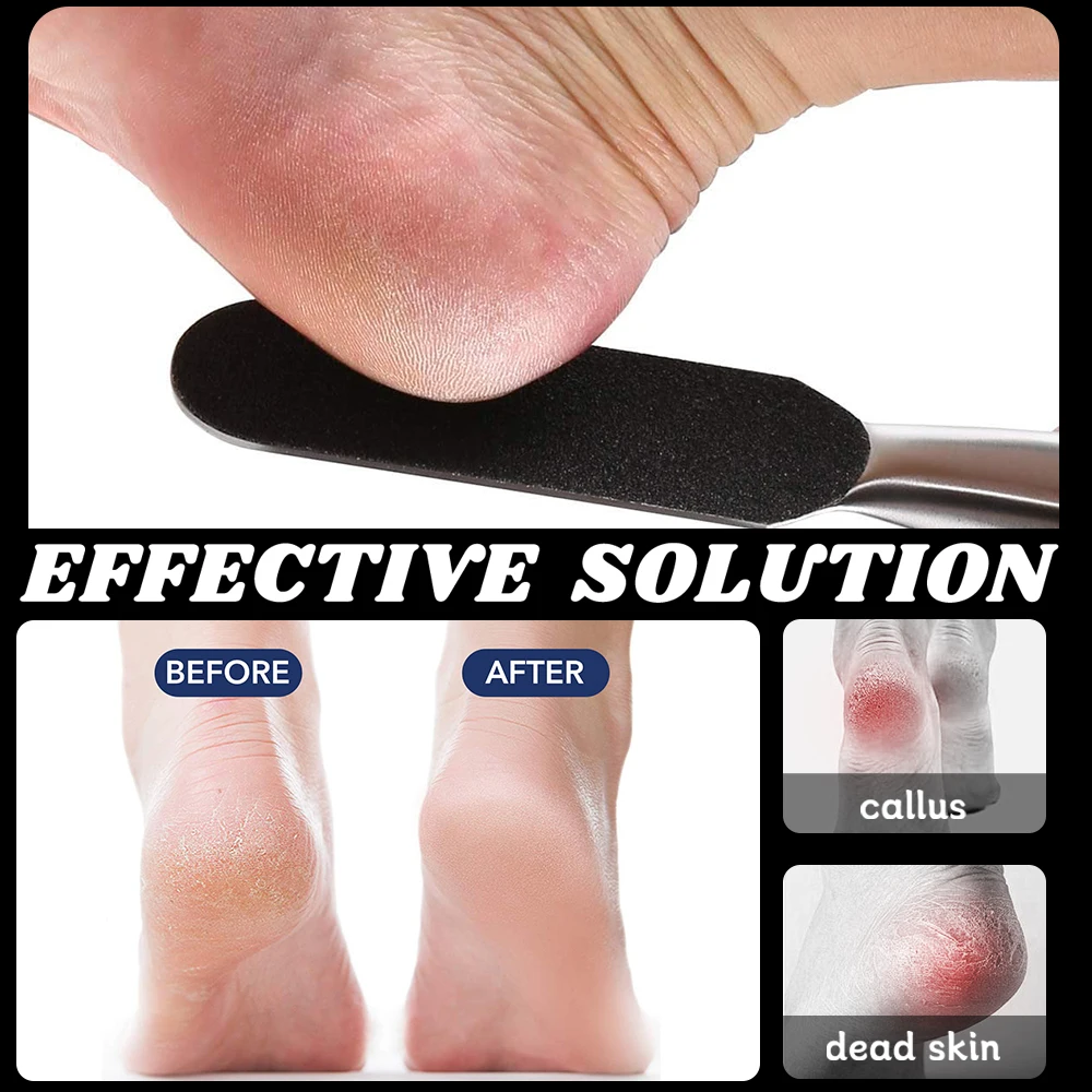 1 pz/1 set professionale pedicure lima per piedi doppio lato con 10 cuscinetti sostituibili rimozione calli calli pelle screpolata in acciaio inossidabile