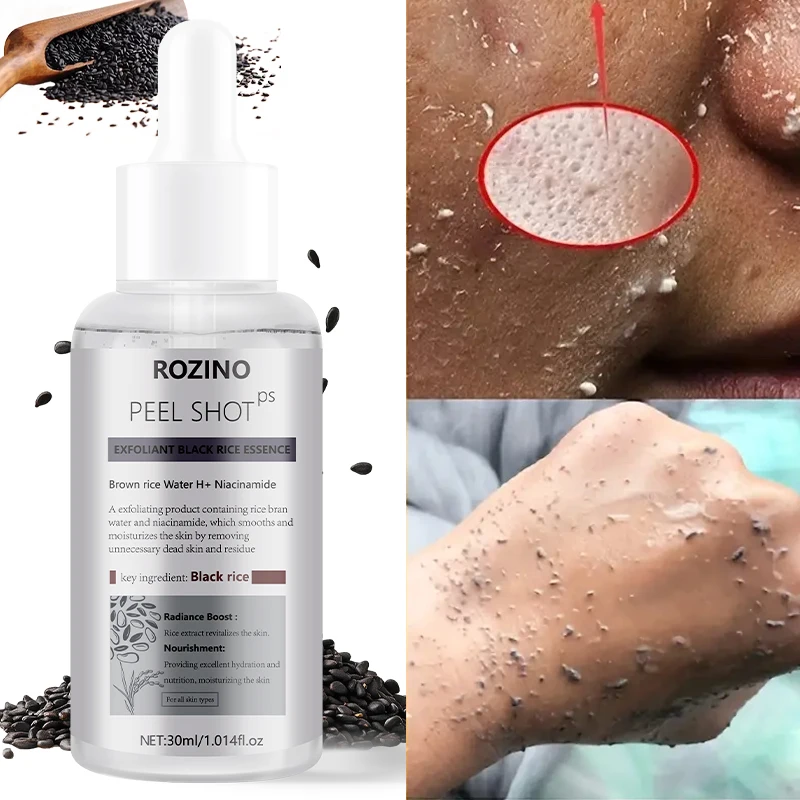 ROZINO Rejuvenating Black Rice Essence has a light and refreshing texture, quickly absorbs into the skin without leaving any sticky residue. Rich in black rice extract and nourishing ingredients, it gently cares for facial skin, soothes dull and rough skin, and softly brightens the skin for a translucent texture. It continuously replenishes moisturizing nutrients, alleviates dry and tight skin, and is suitable for daily facial rejuvenation and moisturizing care for various skin types.