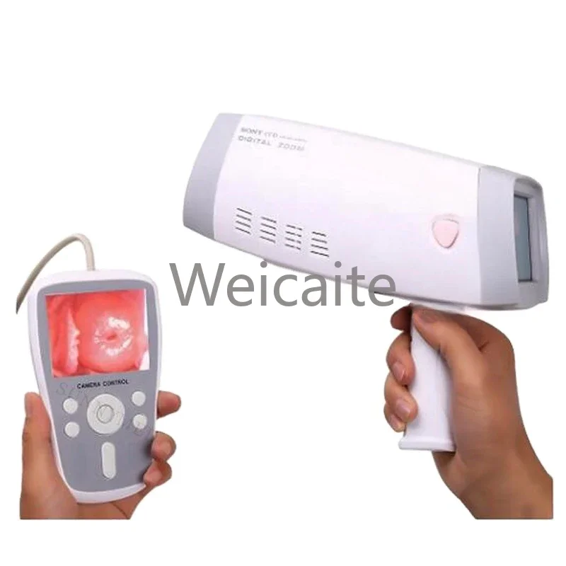 

SY-F005 Handheld Digital Video Colposcope for Clinical Examinations