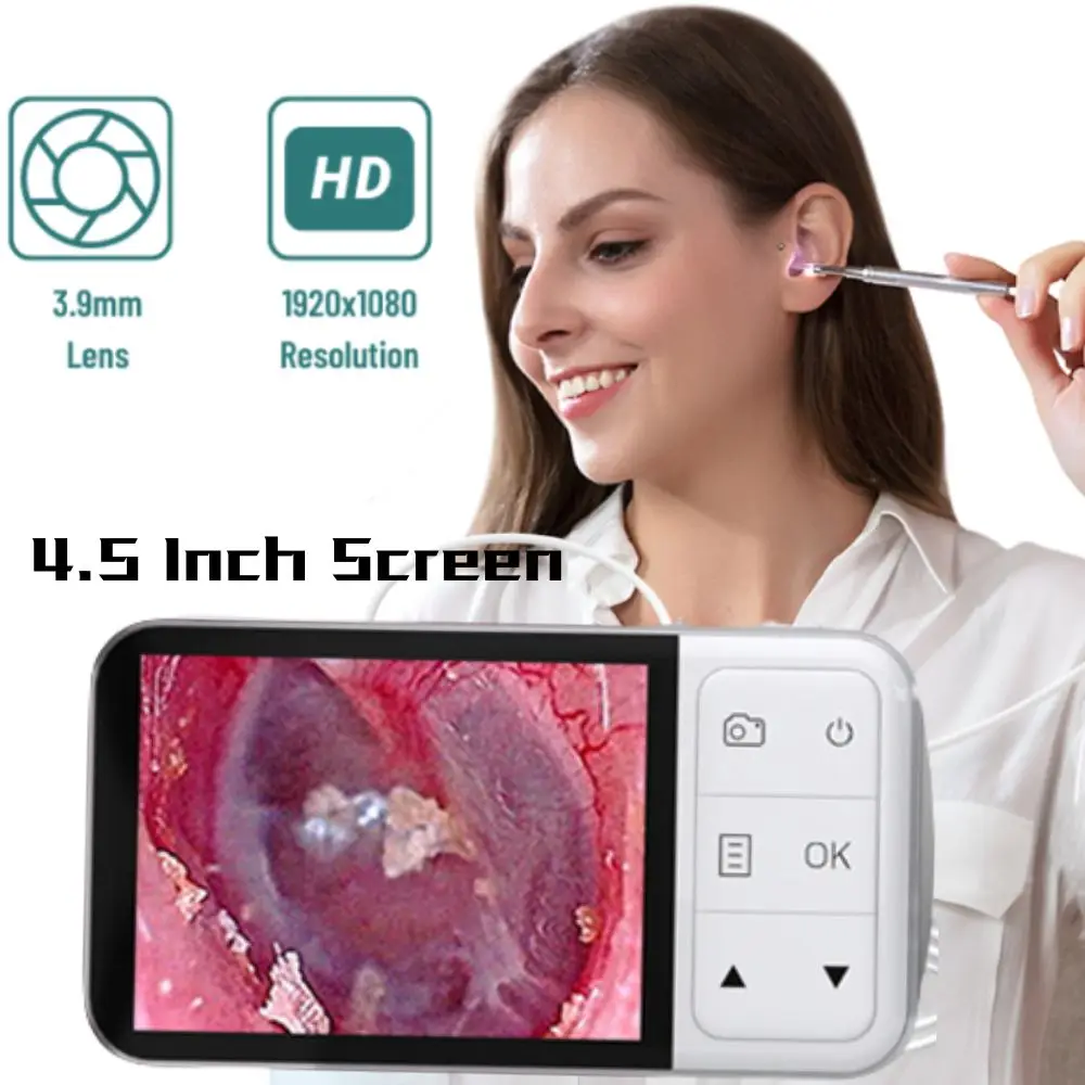 Otoscópio de escopo de ouvido HD de 3,9 mm, ferramenta de remoção de cera de ouvido, otoscópio digital HD 1080P de 4,5 polegadas com 6 LED para inspeção de ouvido doméstica