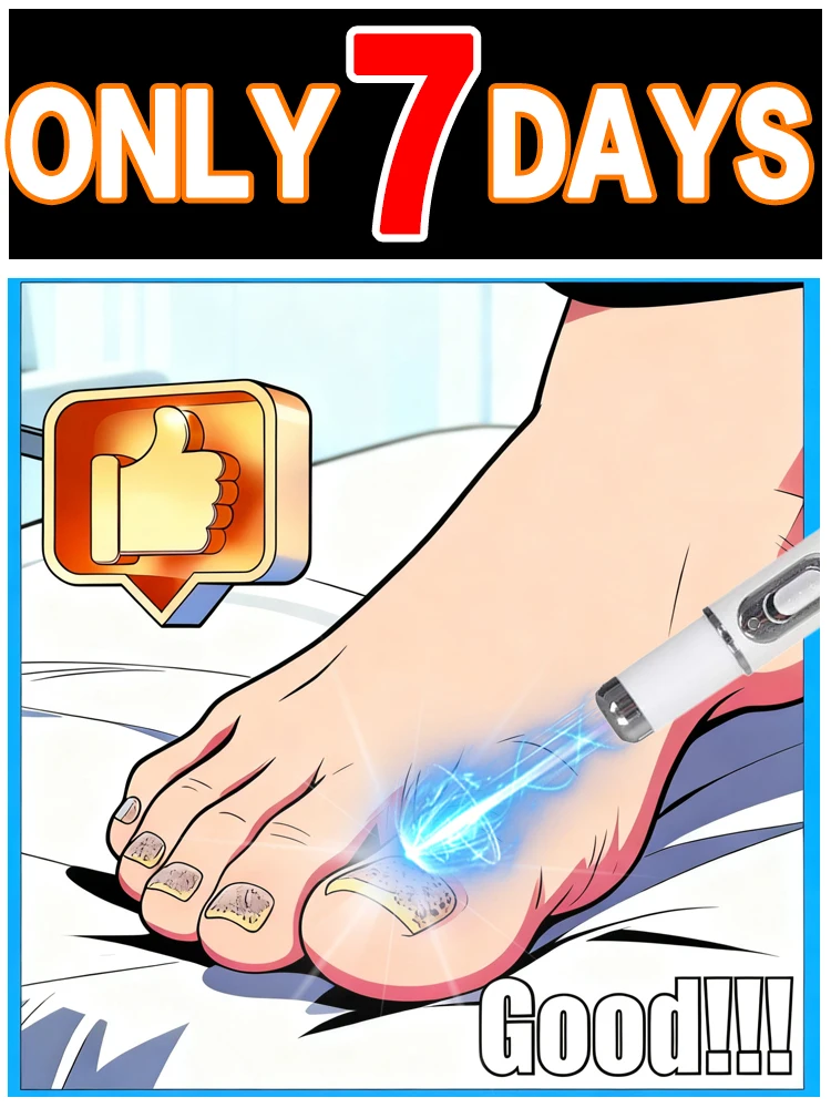 

Пятое поколение лазерной ручки для ногтей цвета шампанскогоs aziemarды. Т