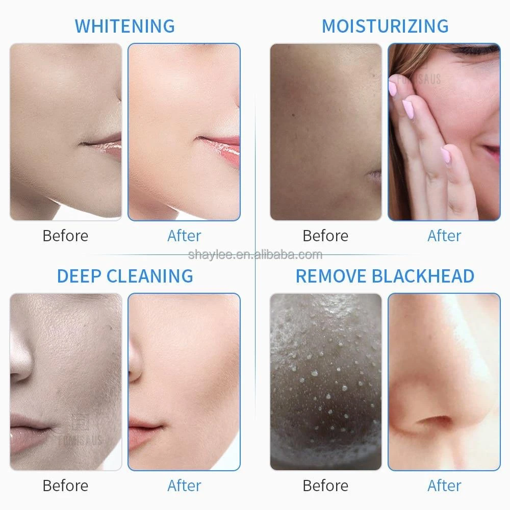 เครื่องบำบัดน้ำ12อิน1เครื่องพ่นออกซิเจนแบบ microdermabrasion S สำหรับร้านเสริมสวยสปาอุปกรณ์ความงามปืน mezo