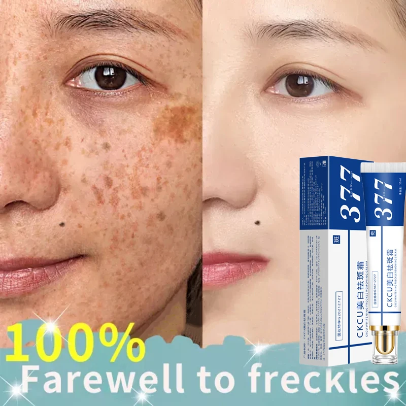 

Effective Whitening Freckle Cream Remove Melasma Acne Spot Pigment Melanin Dark Spots Pigmentation Moisturizing Gel Skin Care