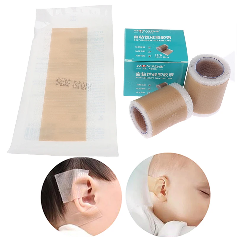 1pcs Medical Silicone Tape Baby Pinna Valgus Ear Correctors Breathing Patch Infant Ear Correction Patch Stickers