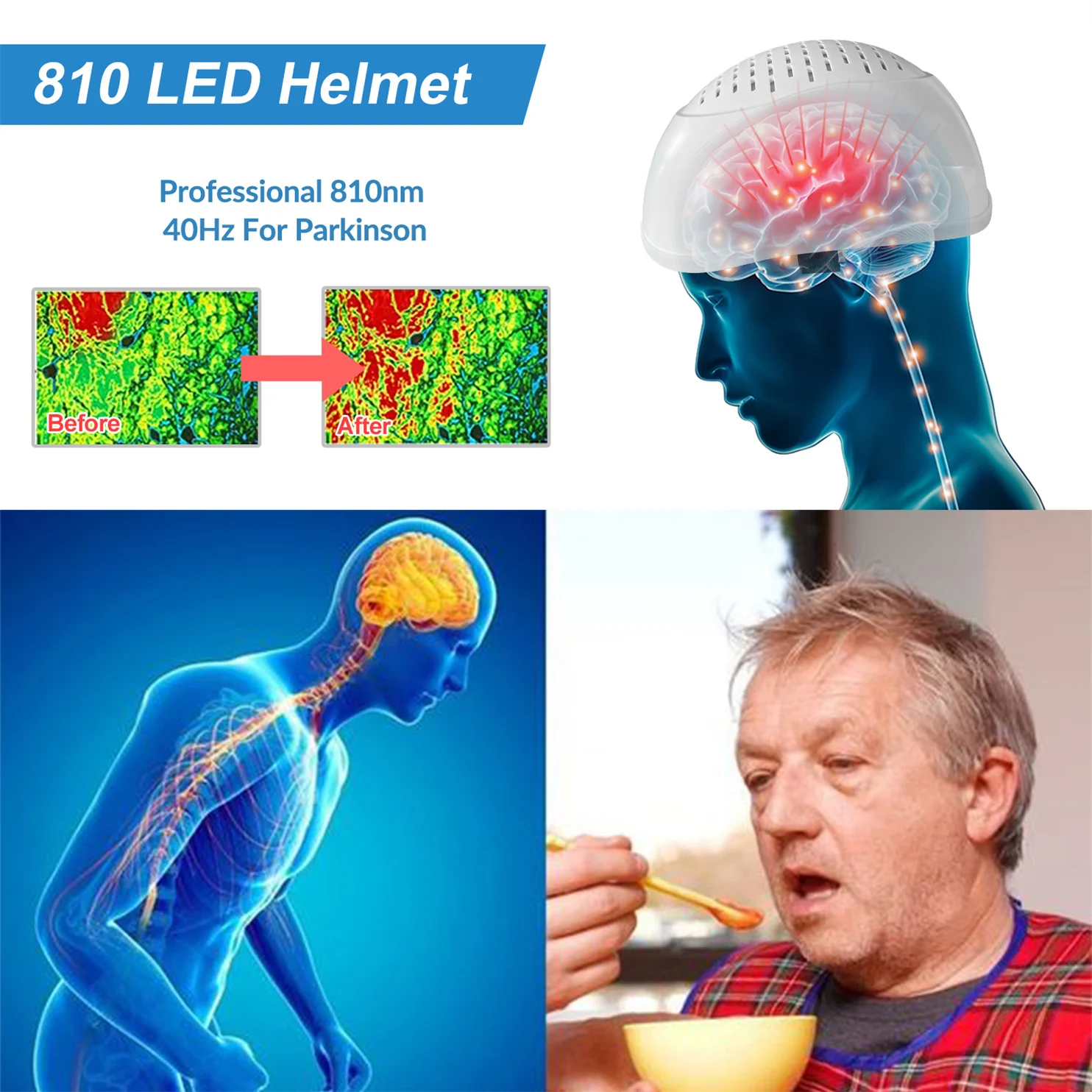 ZJZK Red-Light-Therapy Parkinson Treatment PBM Therapy Helmet 810nm Cerebral Infarction Depression Relief Items Professional