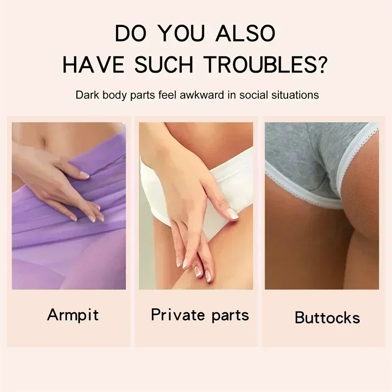 Skin Whitening Cream Private Parts Lightening Whitening Cream for Dark Skin Arm Thigh Body Knees Whitening Brighten Skin Mild