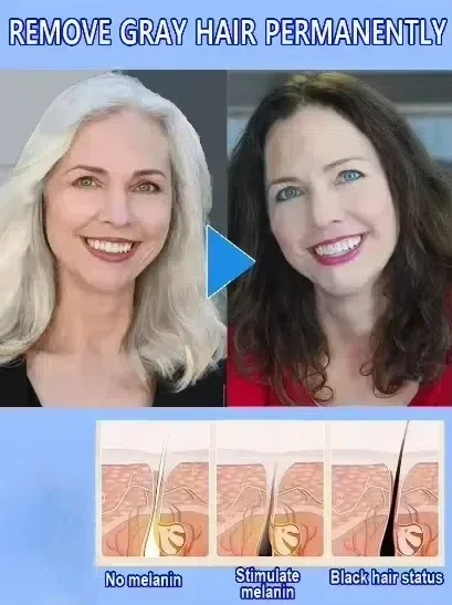 White Hair Remover 2