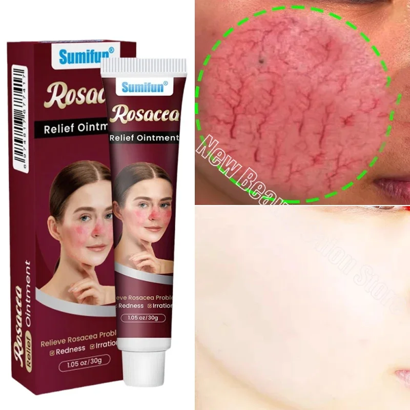 

Instant Facial Redness Repair Cream Soothing Red Blood Rosacea Treatment Improve Sensitive Skin Anti Redness Skin Care Cosmetics