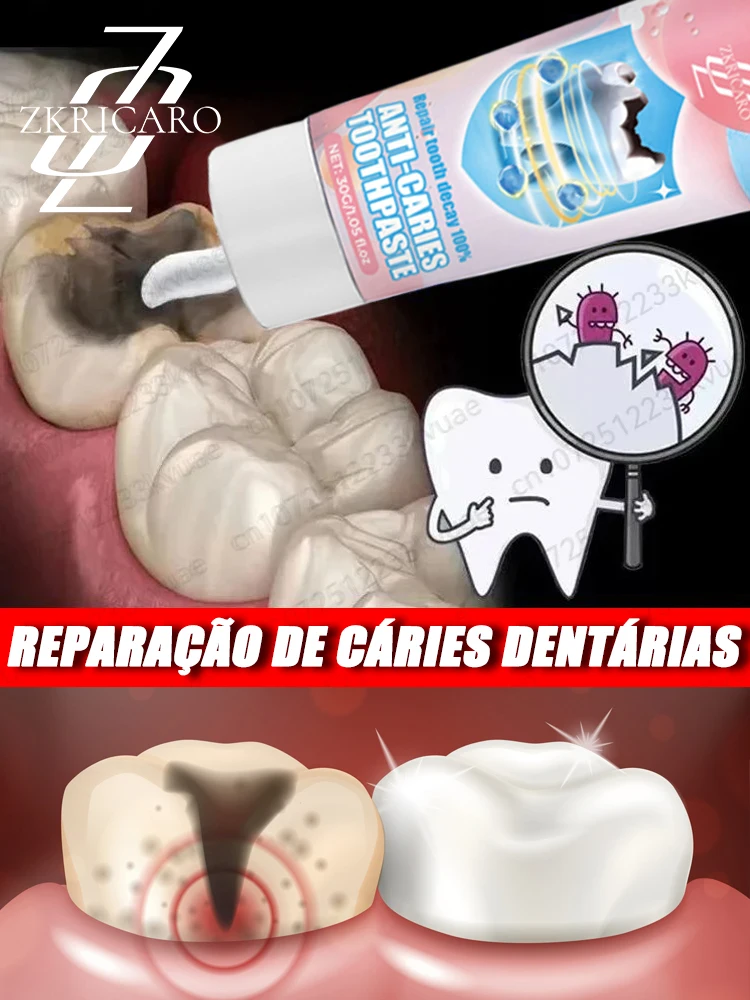 Pasta de dientes anticaries remineralización dental recuperación esmalte reparación fortalecimiento restauración caries protección dental dientes