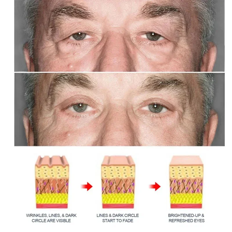 Mężczyźni Retinol przeciwzmarszczkowy krem do oczu przeciw ciemne koła worki pod oczami blaknąć cienka linia liftingu ujędrniający odżywczy pielęgnacja oczu naprawczy