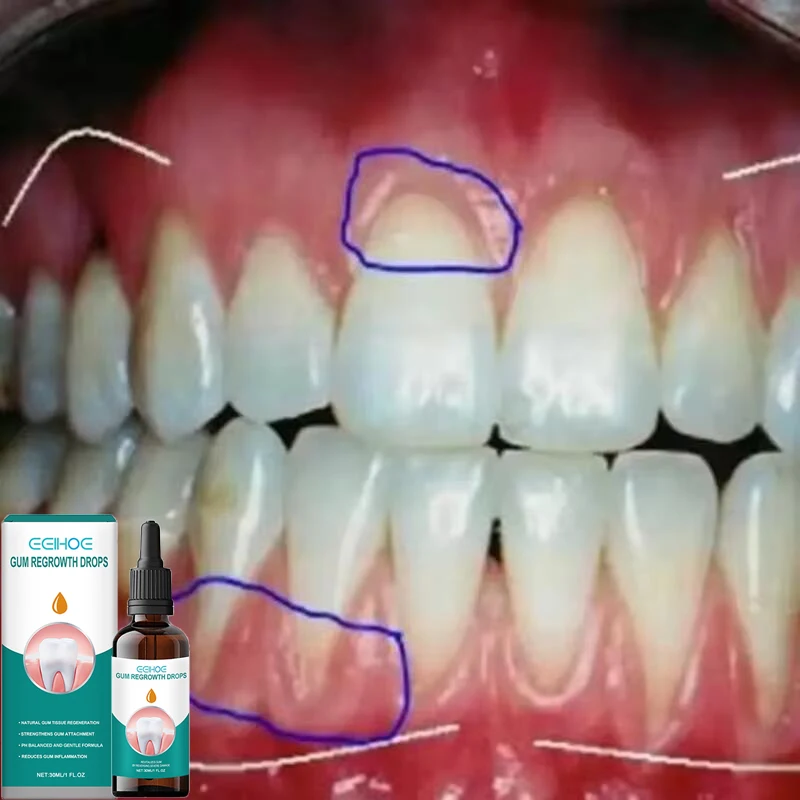 Snel Reparatie Tandvlees Serum Effectief Verlichten Tand Allergie Tand Cariës Gebitsreiniging Tandpasta Verlichten Tand Schade Druppels