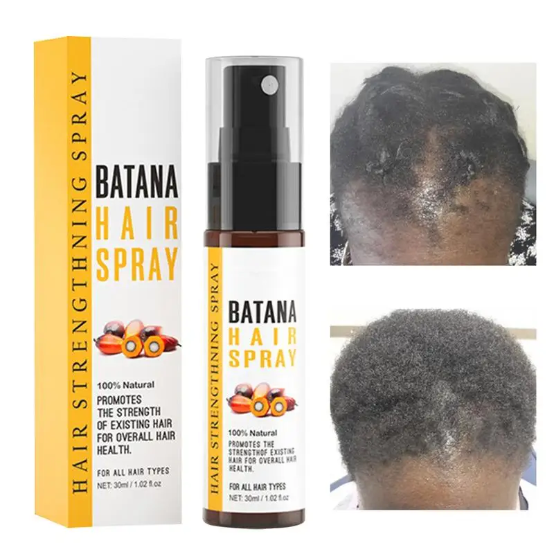 1pcs 30ml African Batana Oil Hair Growth Spray Repair Baldness  Hair Loss Treatments moisturize the scalp aceite para el cabello