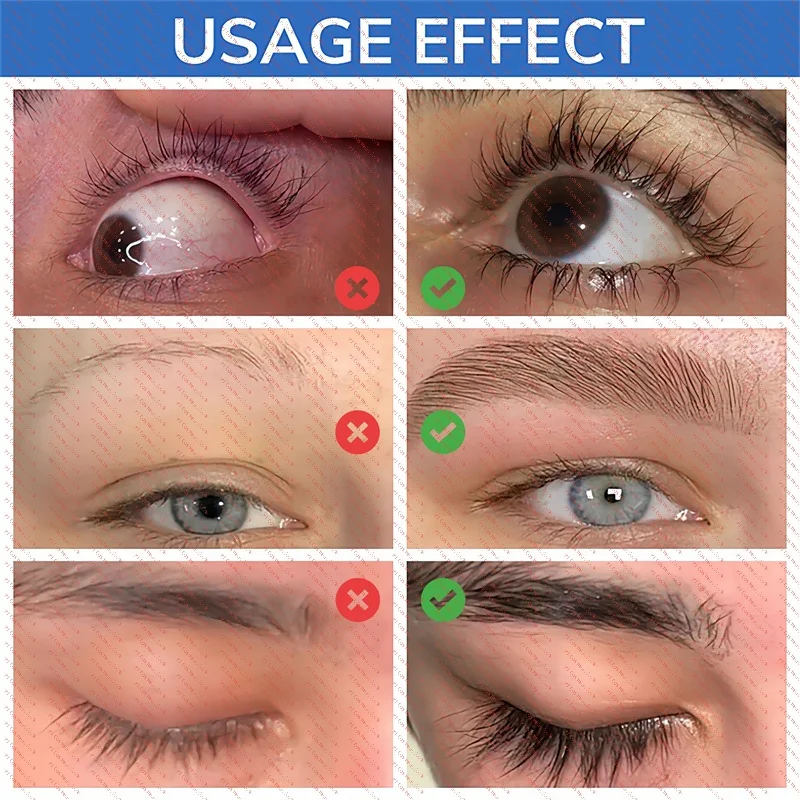 Szybkie Serum na Porost Rzęs Naturalny Wzmacniacz Rzęs Dłuższe Grubsze Brwi Esencja Podnosząca Pełniejsze Rzęsy Pielęgnacja Oczu Koreański Kosmetyk