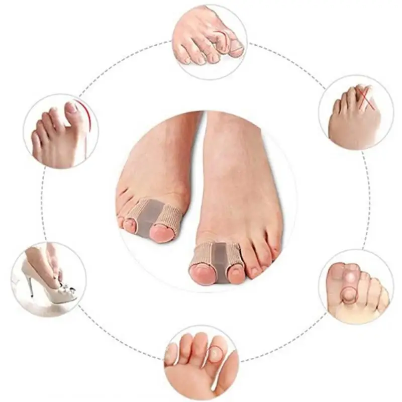 1/2/4 Stuks Siliconen Teen Spreider Separator Bunion Hallux Valgus Corrector Duim Vinger Correctie Stijltang Voetverzorging Tool