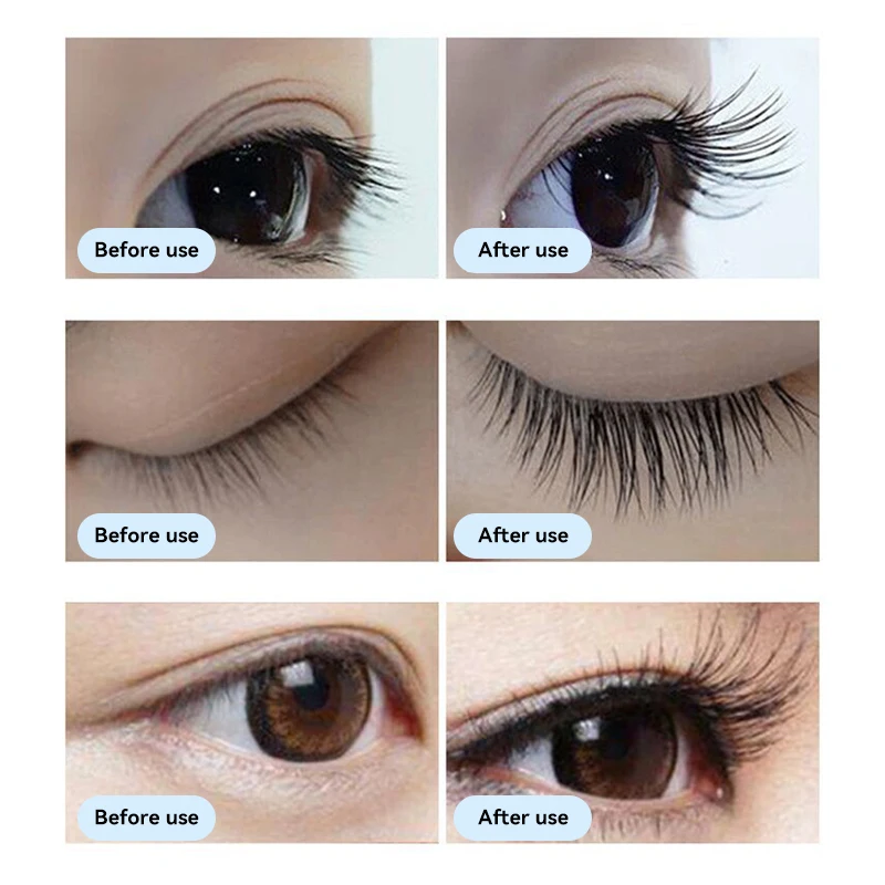 Eyelash Nutrient Dark Curl Eyelash Brow Solution Natural Beauty Promotes Follicle Cell Recovery Increases Eyelash Density