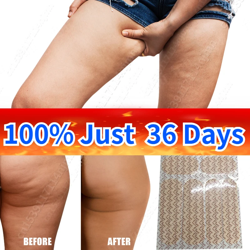 

For VIP Strong Weight Loss Plaster Slim Patches for Leg Arm Lower Body Fat Burning Plaster Anti Cellulite Lose Weight Patch New