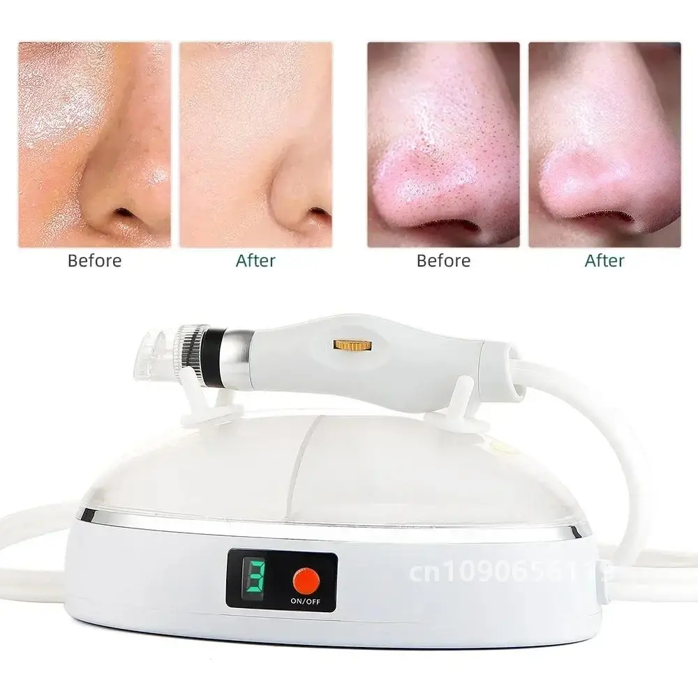 Portable Spray Water Injection Hydro Jet Beauty Machine Vacuum Suction Blackhead Clean Skin Rejuvenation Oxygen Small Bubbles