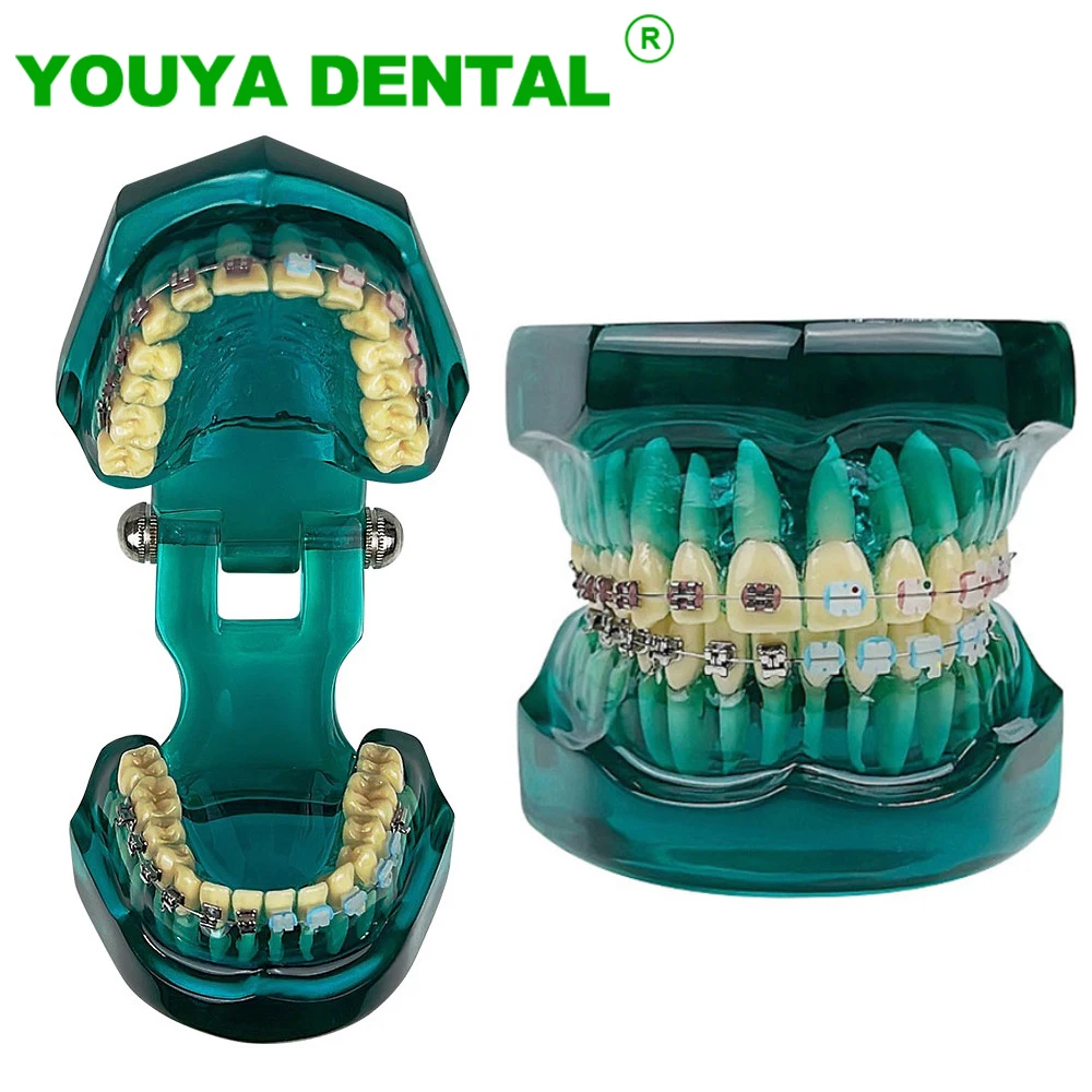 Orthodontic Teeth Model With Self Ligating Metal Ceramic Braces Bracket For Patient Communication Dental Treatment demo Model