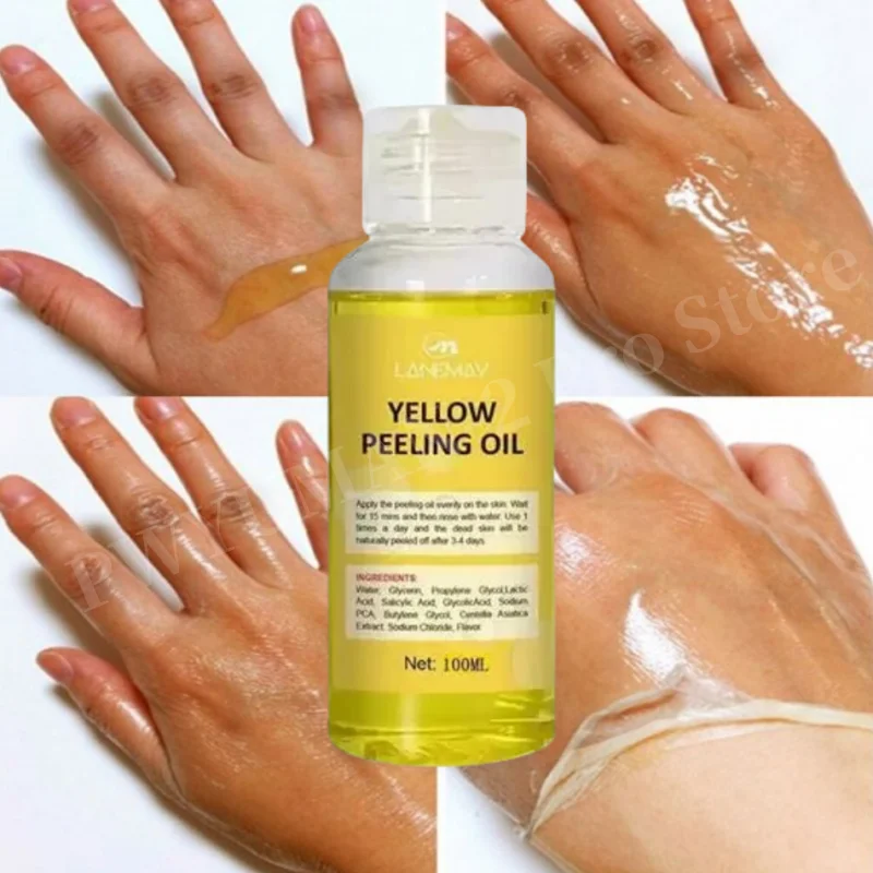 Body Care Exfoliating Yellow Peeling Oil 100% Organic Bleaching Dark Skin Serum Dark Knuckles Fast Whitening Korean Cosmetics