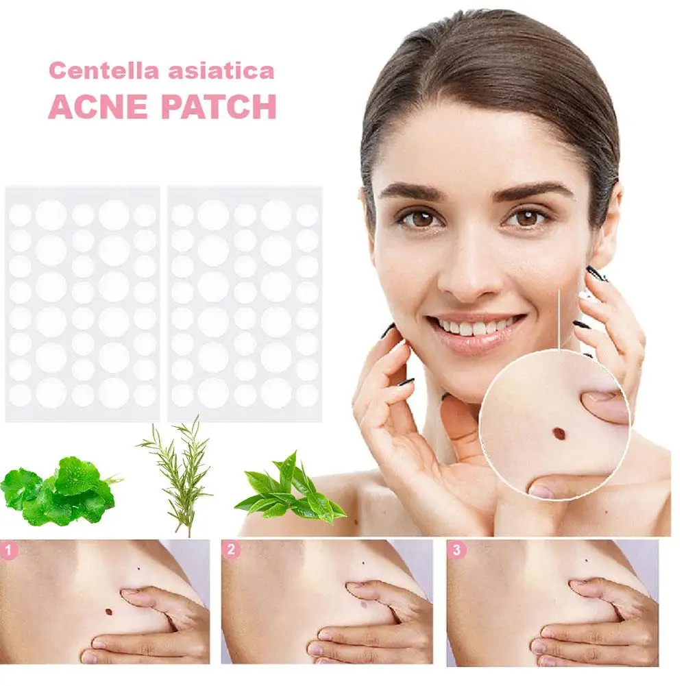 Patch autocollant imperméable pour le traitement de l'acné, outil de suppression des boutons, masque facial anti-taches, soins de la peau, 72 pièces