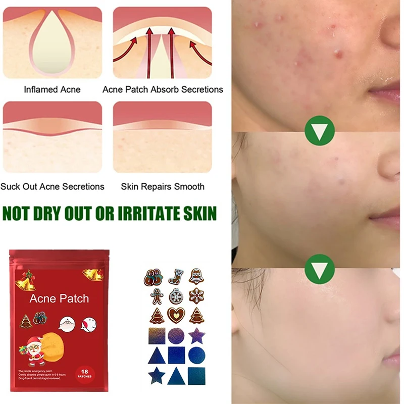 18/36 Stickers Christmas Pimple Patch Acne Invisible Acne Removal Skin Care Stickers Concealer Face Spot Beauty Makeup Tools