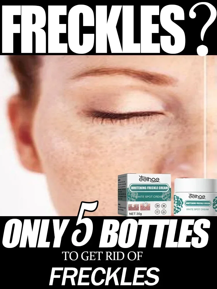 Removal Dark Spots Freckles Brighten Facial Skin Firming Whitening Frckle Cream Products Reduce Melanin Lighten Dark Skin