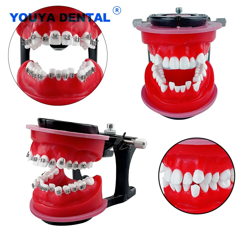 Dental Practice Teeth Model With Ortho Metal Brackets Orthodontic Model For Studying Teaching Patient Dentist Treatment Lab