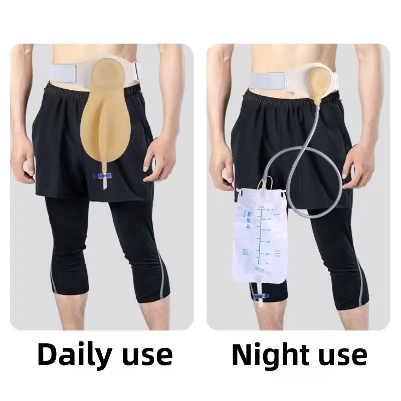 Urostomia Bag (Latex Bladder Ostomy Bag) Bladder Waist Side Pocket Drainable Pouch Cuidado Ostomia Urine Bag -1pcs
