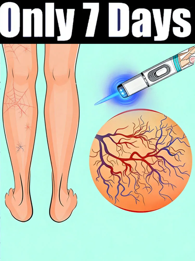 

Ручки синего света защищают свое здоровье Cheonwon mart, бесплатная доставка