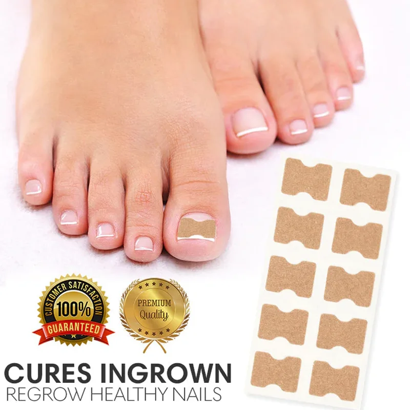 Ingrown Toenail Correction Sticker Adhesive Toenail Patch Elastic Nail Treatment Corrector Sticker Foot Care Tools