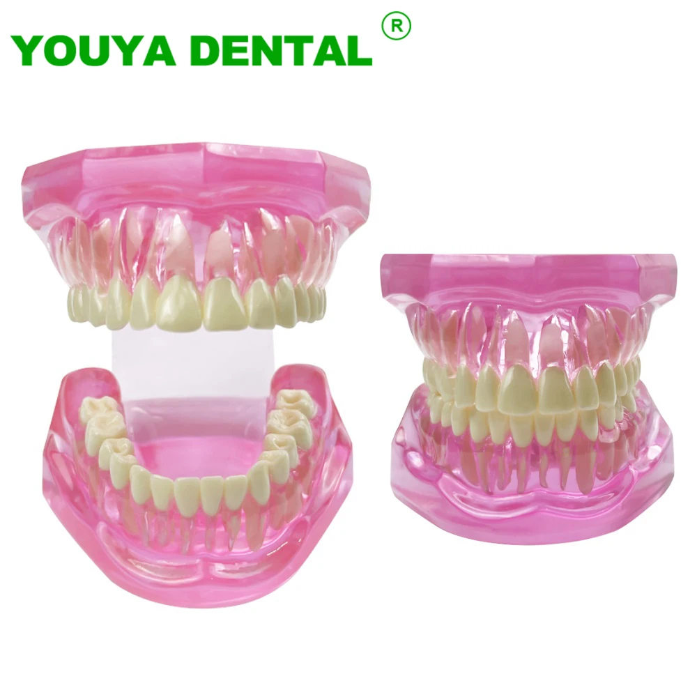 Normal Dental Model Pink Transparent Standard Teeth Jaw Model Typodont For Dentist Student Teaching Study Demonstration Tools