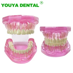 Normal Dental Model Pink Transparent Standard Teeth Jaw Model Typodont For Dentist Student Teaching Study Demonstration Tools