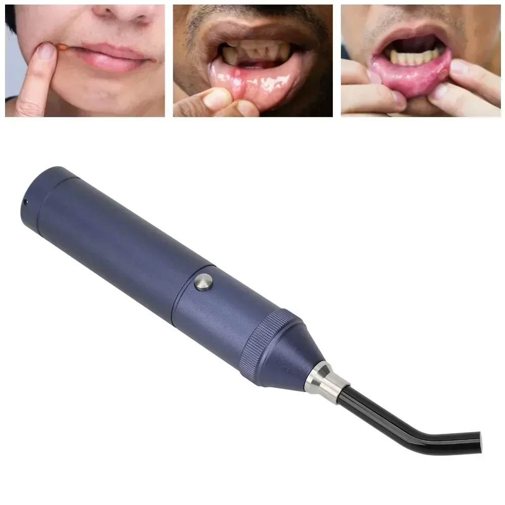 Profession Red Blue Light LED Physiotherapy Flashlight Canker Sore Treat Devices Light Therapy Devices Lip Nose Ears Body Muscle