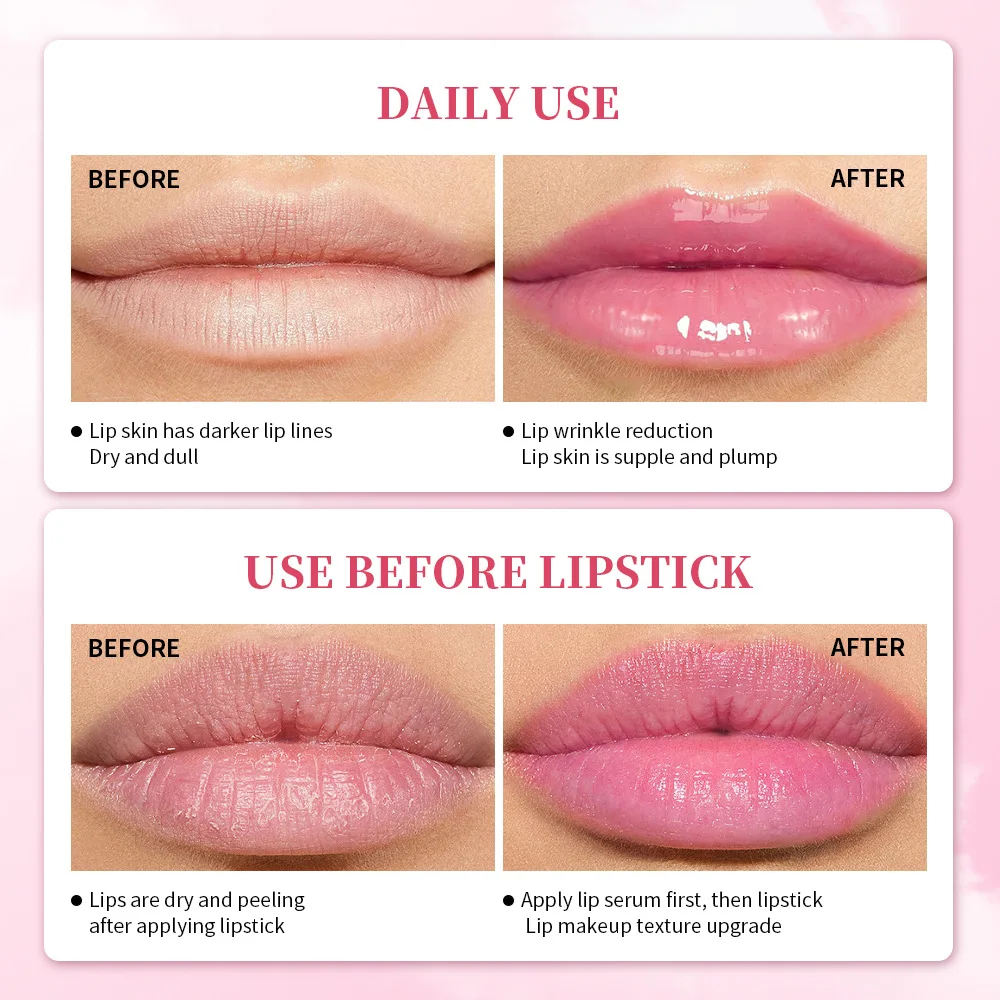 Pink Lips Serum Lip Balm Plumper riduce le linee sottili illumina il lucidalabbra Anti-essiccazione rimuovi l'oscuramento idratante trucco labbra Sexy