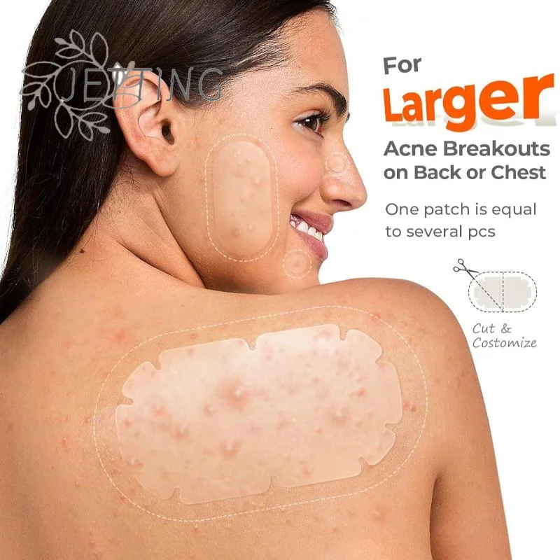 Hot Large Pimple Patch Bulk For Face Hydrocolloid Multi-shape Invisible Removal Acne Patches Covering Body Forehead Chin Blemish