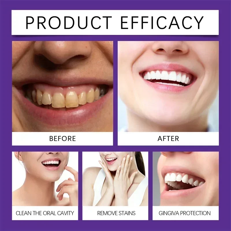 Rapid gum repair mineral powder effectively beautifies teeth and relieves tooth damage