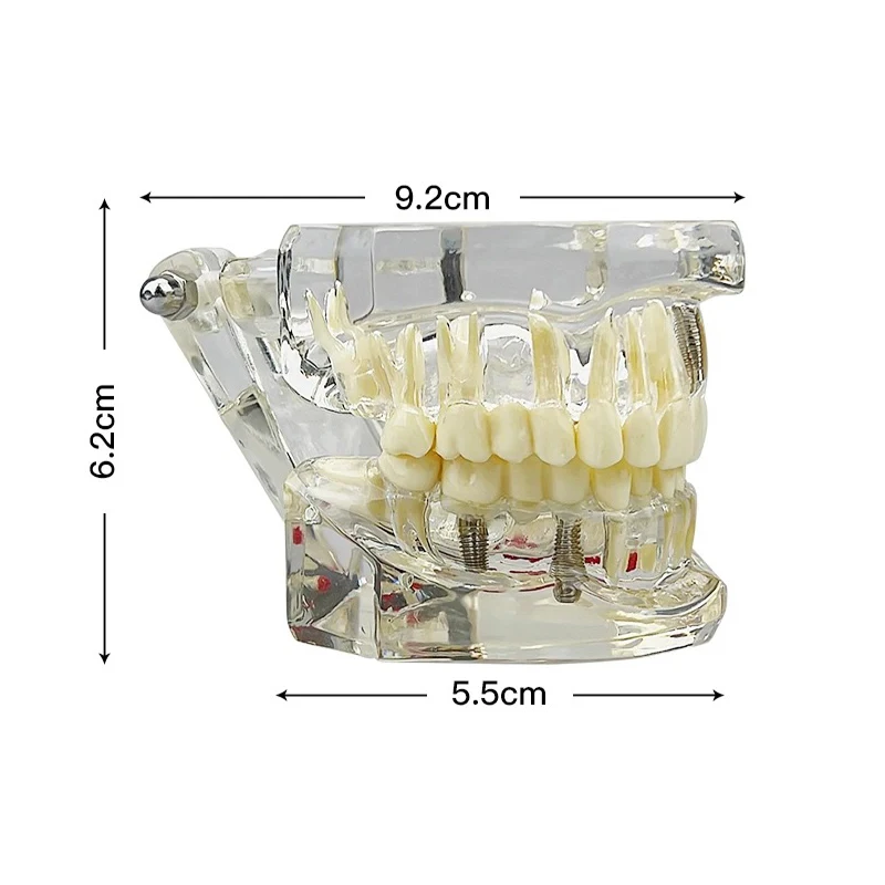VVDental Teeth Repair Model Disease Teeth Model for Dentist Student Practice Training Studying Dentistry Tools
