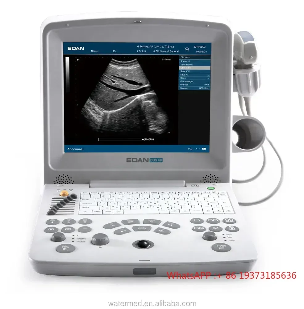 Edan DUS 60 veterinary Ultrasound scan Machine