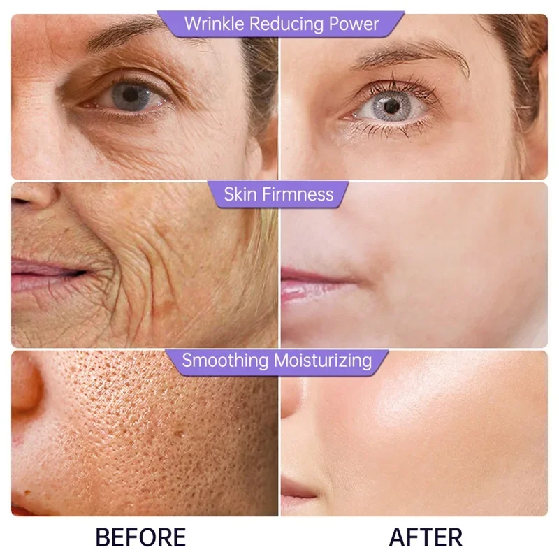 Collagen Face Serum Wrinkle Removal Anti Aging Forehead Fine Lines Lifting Facial Serum Repairing Facial Essence 40ml Skin Care