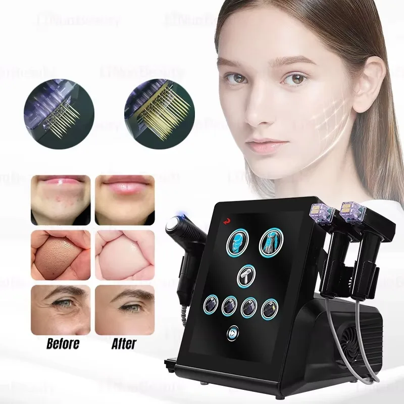 High‑Frequency Cold Hammer Home Skin‑Care Machine For Skin Tightening Scar Repair Acne Treatment Facial Renewal Beauty Instrumen