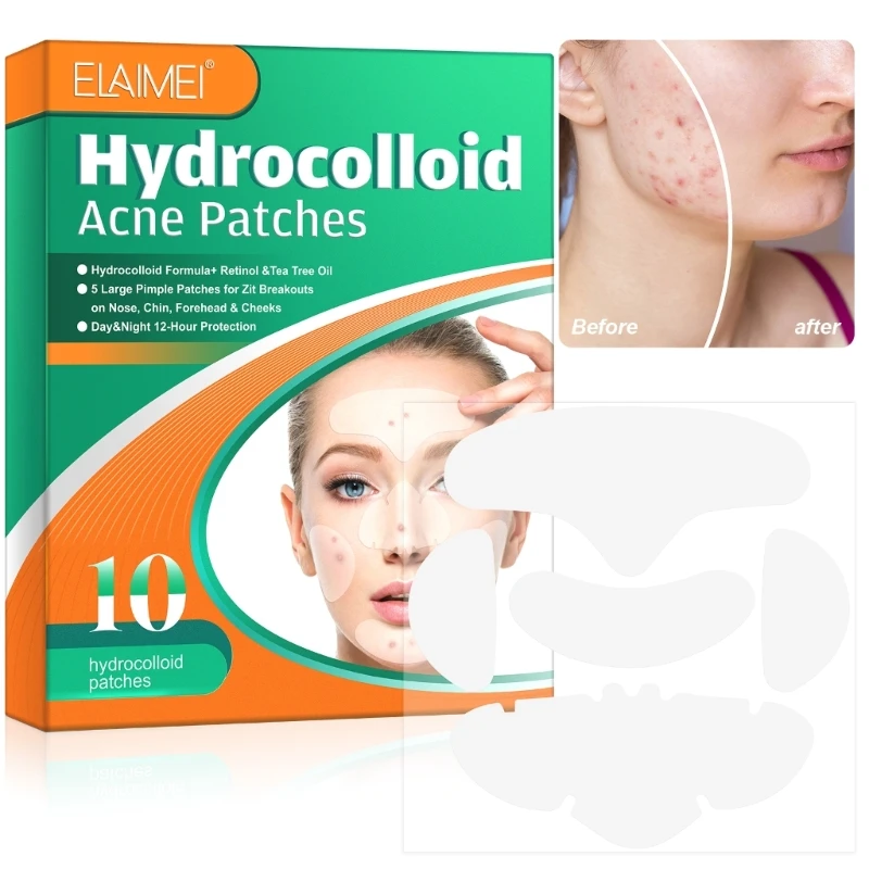 5 in 1 Hydrocolloid Acne Pimple Patch Remover Patch สิวหัวดำ Blemish ลบผิวหน้า  ดูแลผู้หญิง ผู้ชาย Dropship