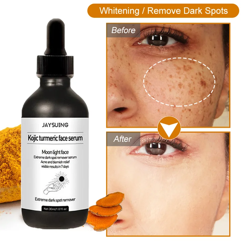 

Freckle Whitening Face Serum Turmeric Oil Fade Dark Spot Brighten Removal Pigment Melanin Correcting Essence Beauty Skin Care